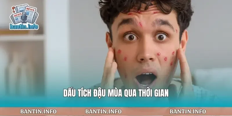 Dấu tích đậu mùa qua thời gian